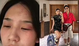 何美延家暴