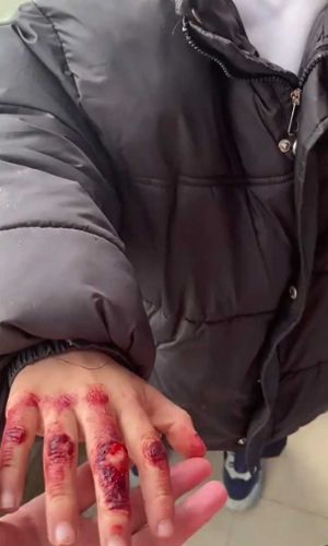 校园霸凌