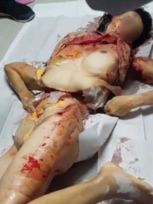 人肉叉烧包
