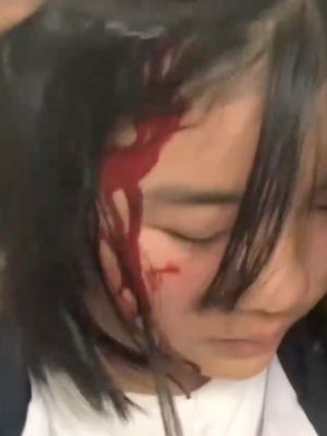 云南玉溪十一中