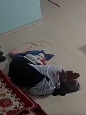 鲜血喷涌