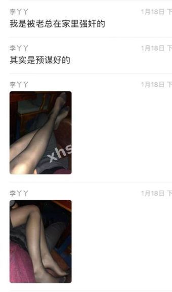 黑丝长腿