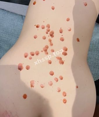 成人爆料