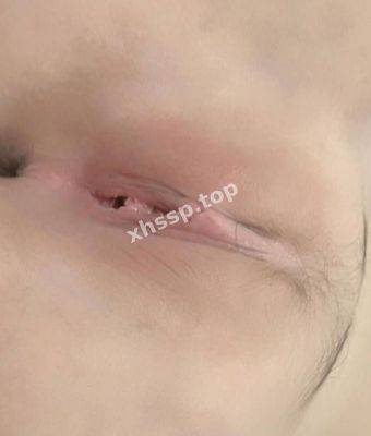 私密照曝光