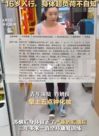 整形过度