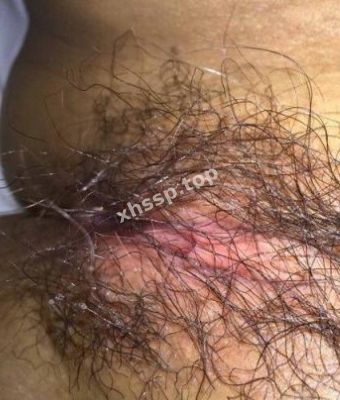 宾馆被男友偷拍
