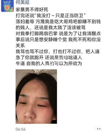何美延家暴