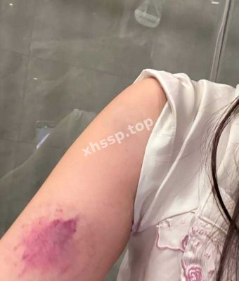 何美延家暴