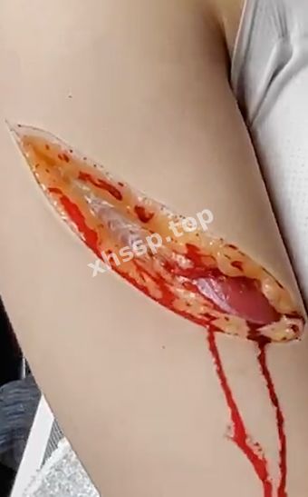 死亡